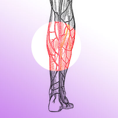 What-is-Venous-Insufficiency