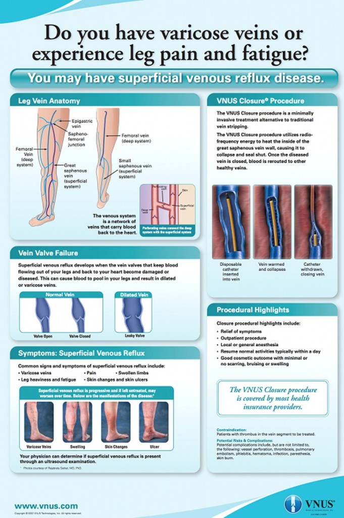 vveins1-681x10241